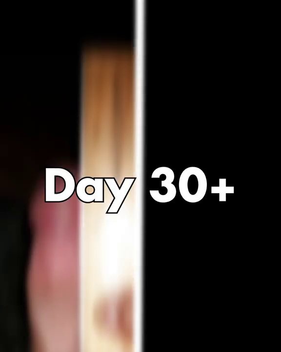 Day 30+